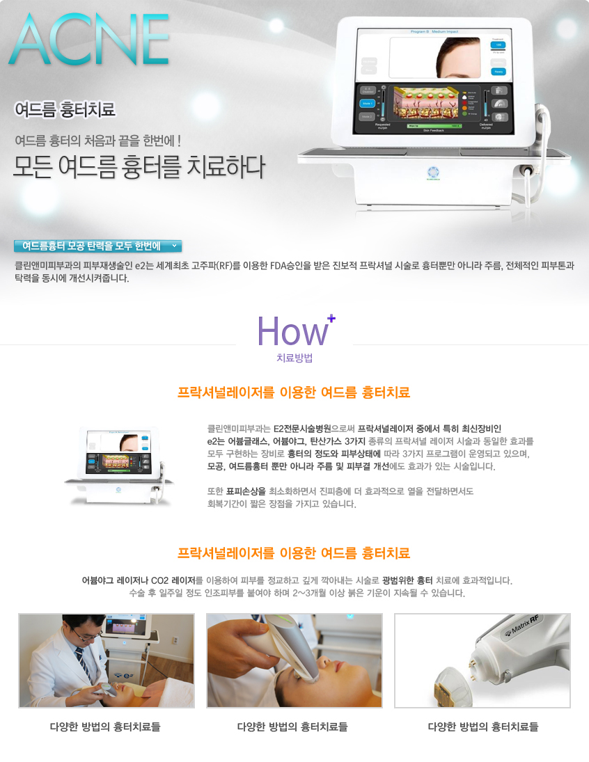 여드름 흉터치료 내용