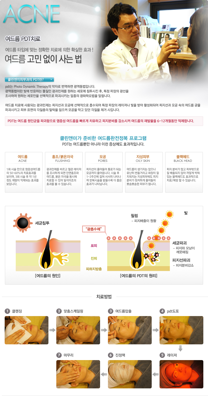 여드름 pdt치료